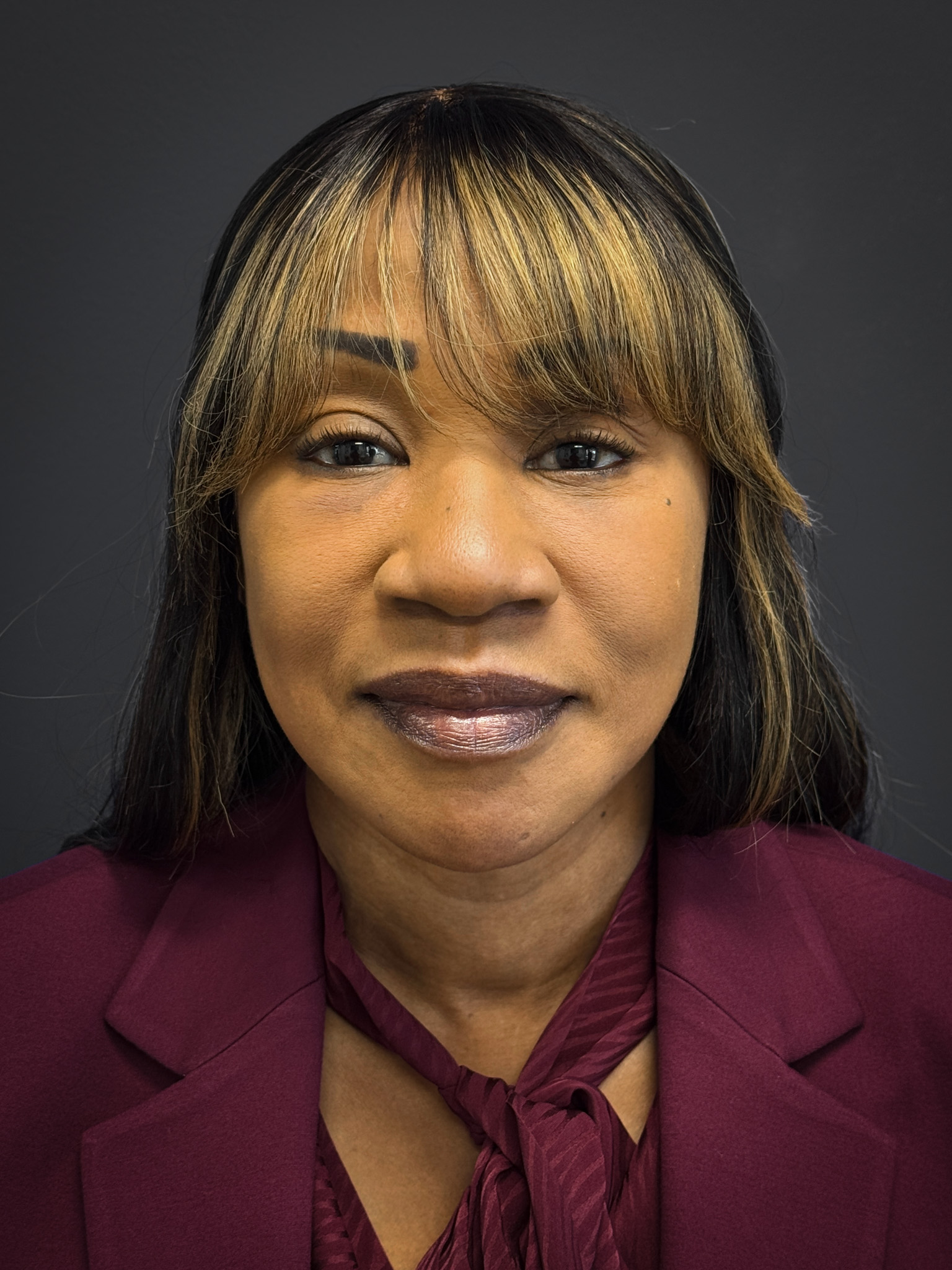 Facelift-Lower-Blepharoplasty-Case--6866 | After Facelift 1