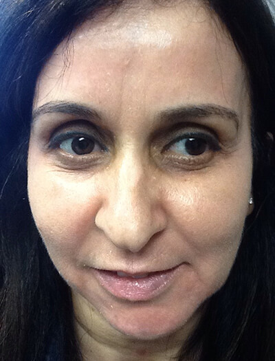 Case--36 | After Skin Care 1