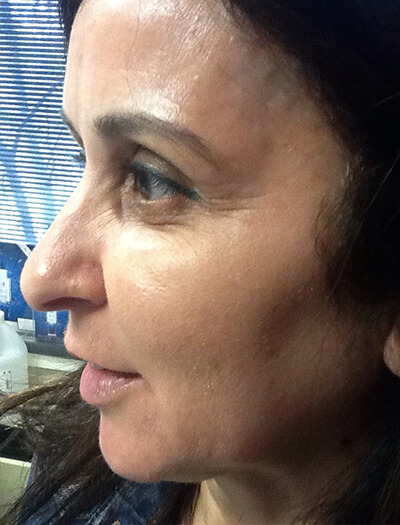 Case--36 | After Skin Care 2