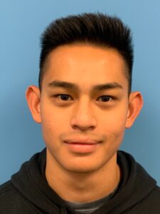 Otoplasty-Case--2681 | Before Otoplasty 1