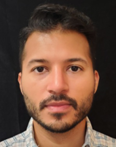 Rhinoplasty-Case--379 | After Rhinoplasty 1