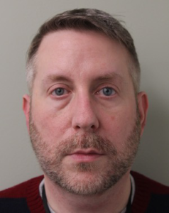 Lower-Blepharoplasty-Case--359 | Before Dr. Arjun Kanuri 1