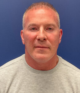 Facelift-Case--5246 | After Facelift 1